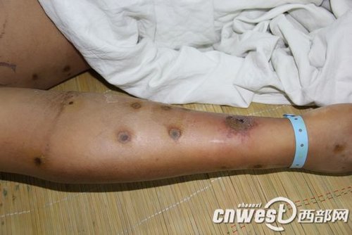 点击浏览下一页